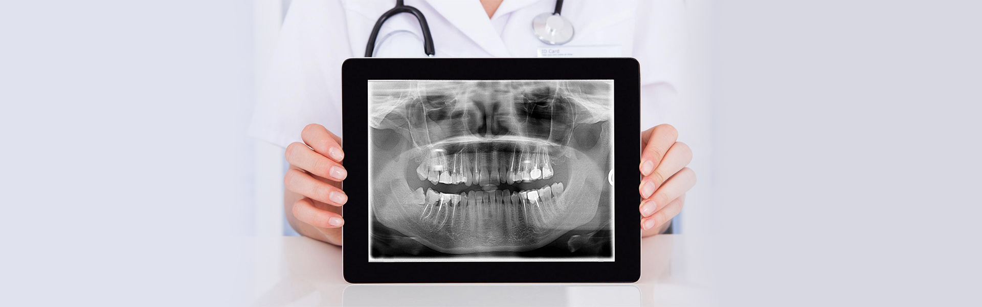 The Importance of Dental X-Rays during an Examination
